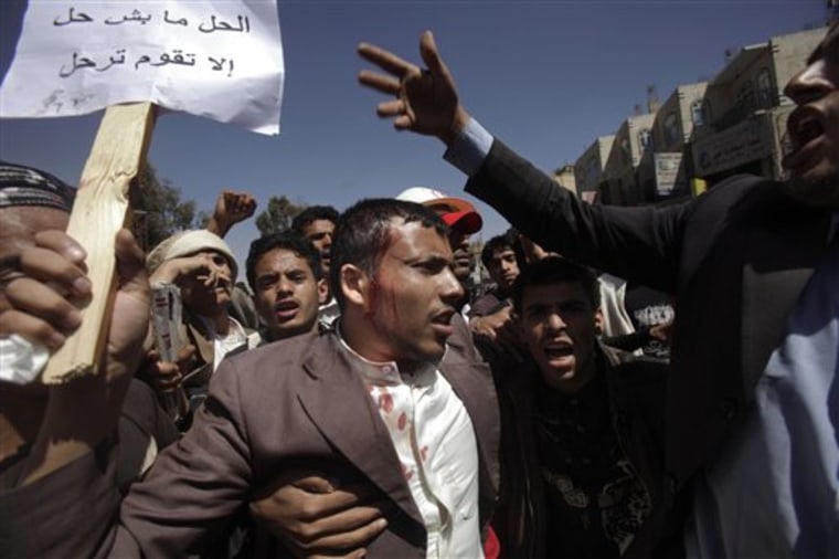 A wounded anti-government demonstrator is helped by other demonstrators after being hit by a stone thrown by Yemeni government supporters during clashes in Sanaa, Yemen, Saturday, Feb. 19, 2011.  Hundreds of Yemenis began demonstrating early in the morning Saturday outside the university in Sanaa demanding the ouster of the country's longtime ruler as they marched towards the Justice Ministry. \"The people want the ouster of the regime,\" they chanted. . (AP Photo/Muhammed Muheisen)